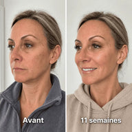 Bandeau Sculptant au Collagène Rituéa™